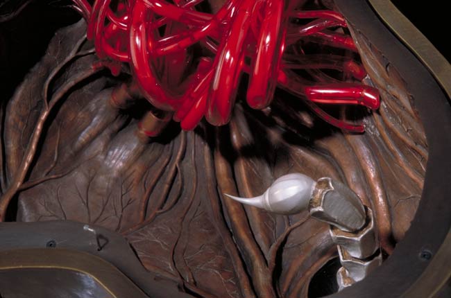 Five Year Cure, music box